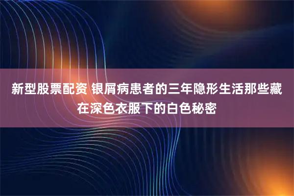 新型股票配资 银屑病患者的三年隐形生活那些藏在深色衣服下的白色秘密
